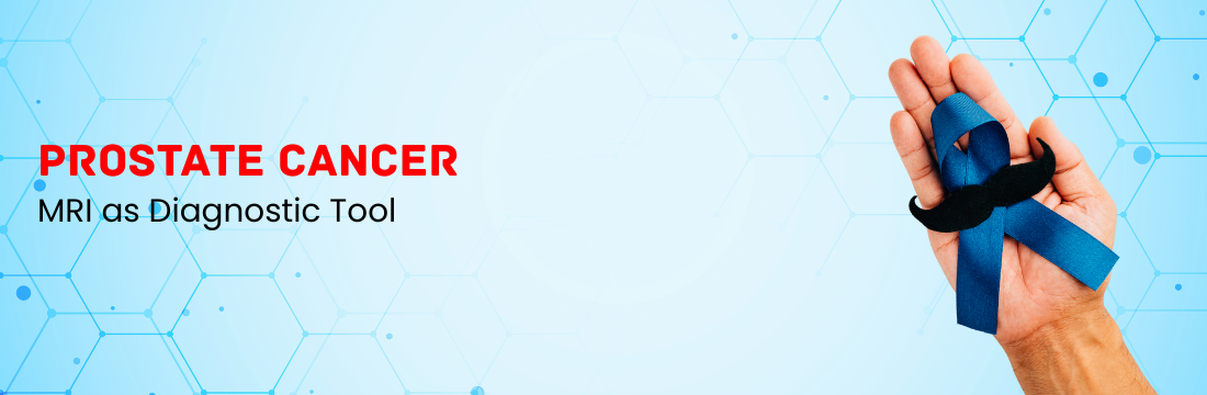 Prostate Cancer and MRI as Diagnostic Tool